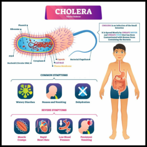हैजा के लक्षण (Symptoms of Cholera)